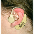 Типы слуховых аппаратов